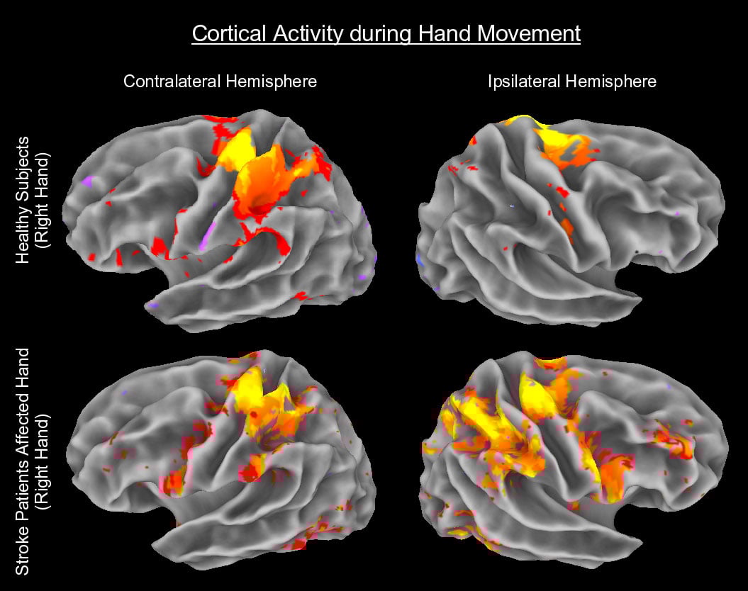 Neuromarketing 101: Your Guide To Getting Your Message Across
